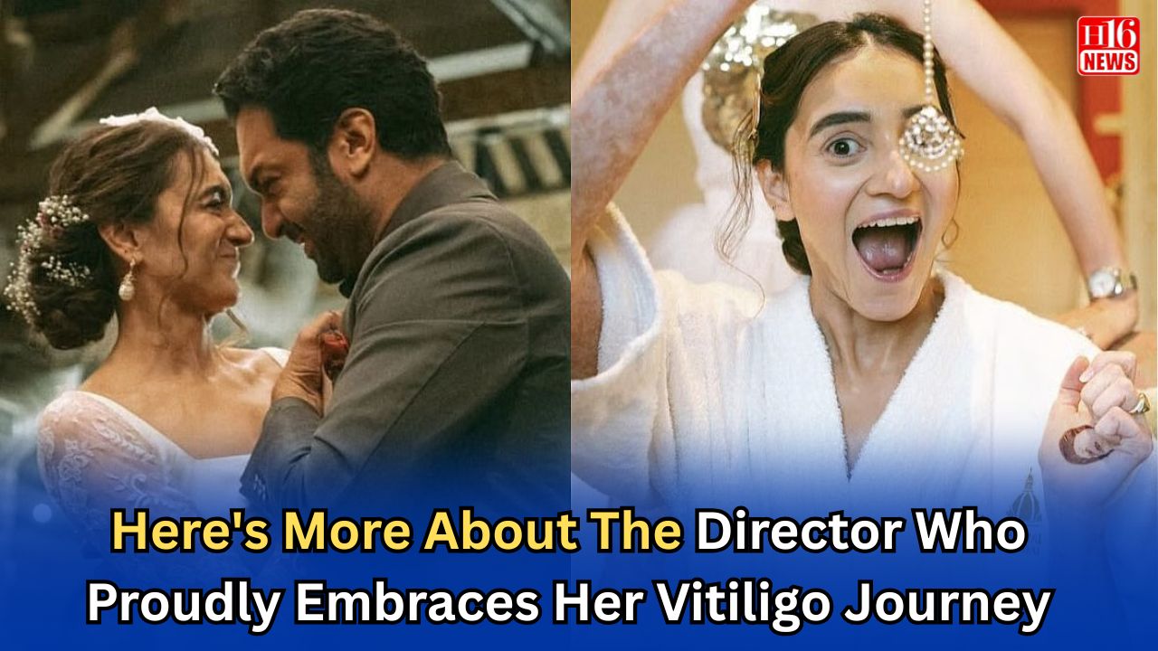 Here's More About The Director Who Proudly Embraces Her Vitiligo Journey